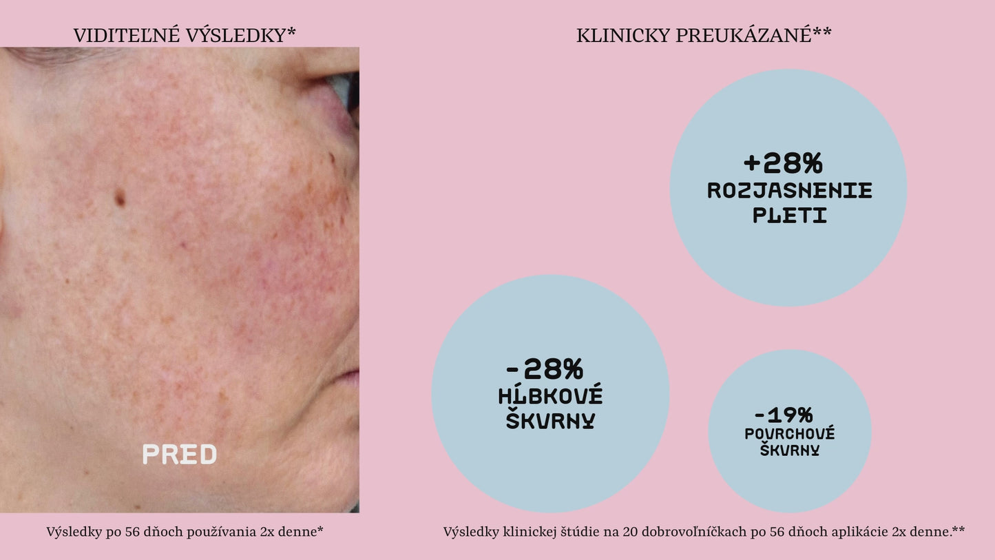 Infografika výsledkov klinickej štúdie na redukciu pigmentových škvŕn: o 28 % jasnejšia pleť a úbytok hĺbkových škvŕn po 56 dňoch používania kozmetiky Modrá púpava.